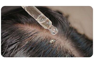 Hoofdhuid uit balans? Zo herken je een scalp burn-out 